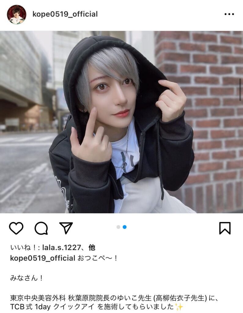 リアルピースこぺの二重整形についてのインスタ投稿